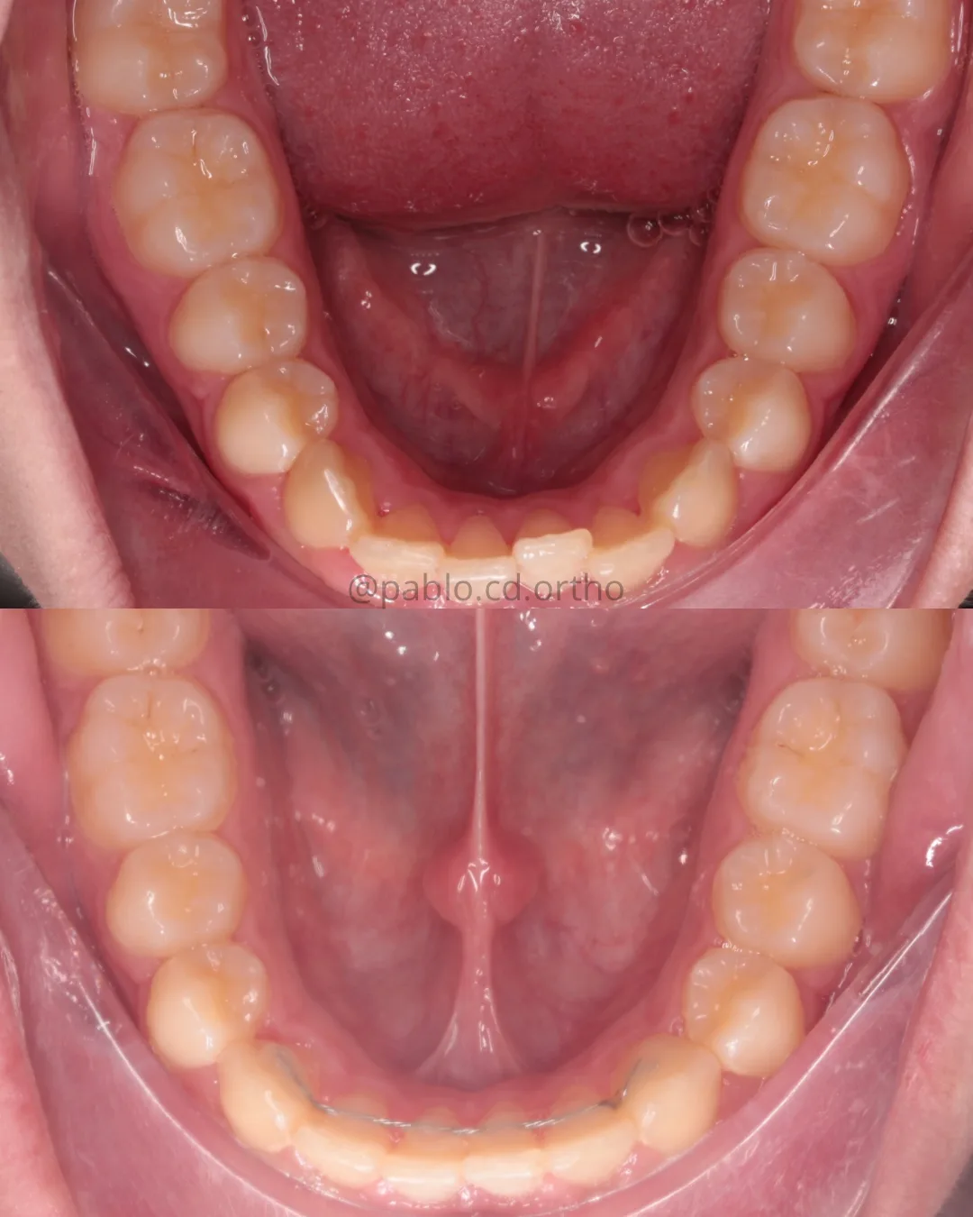 @pablo.cd.ortho (6)