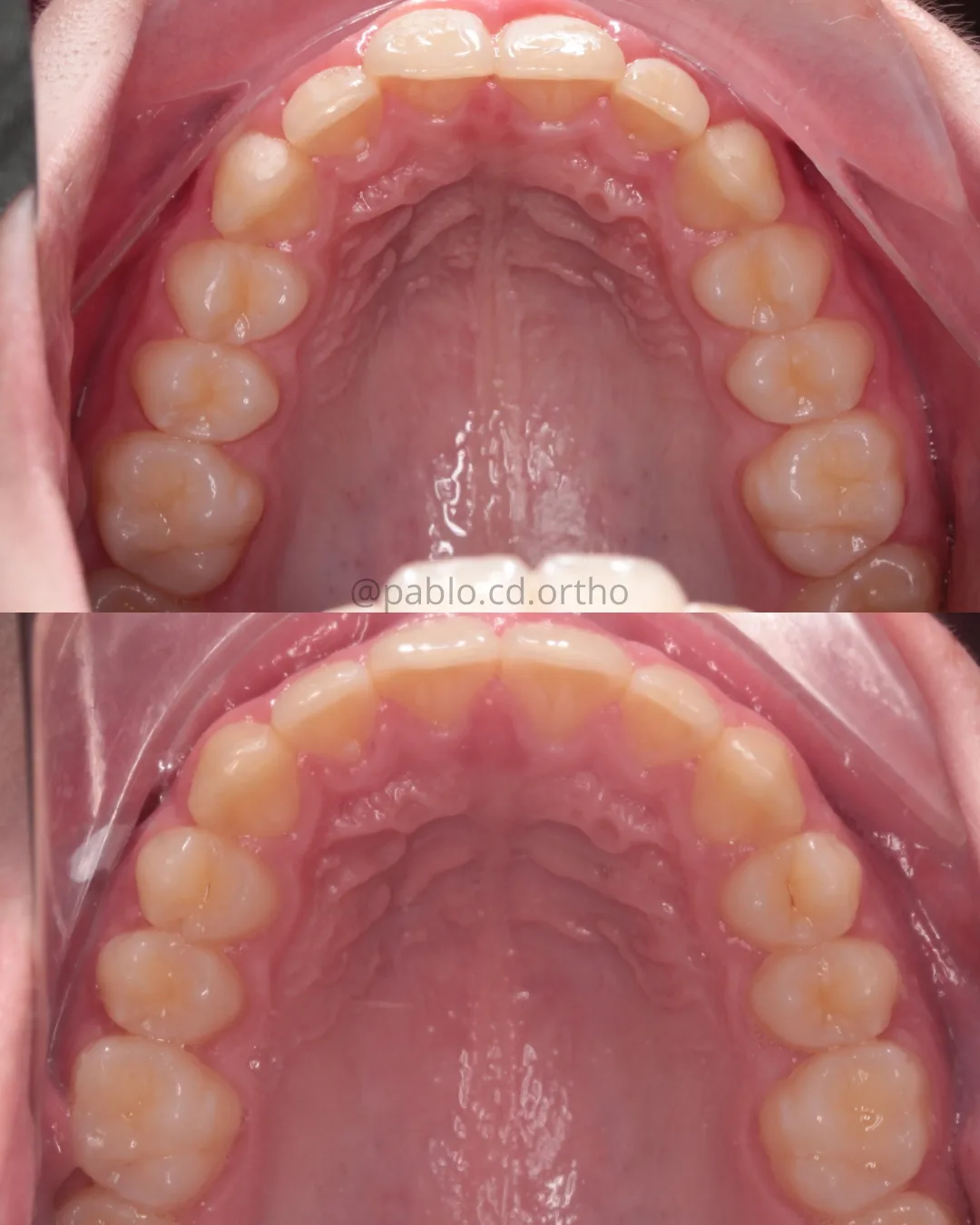 @pablo.cd.ortho (7)